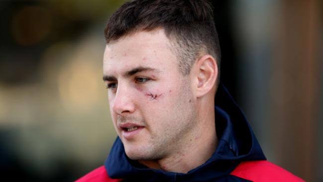Roosters’ Star, Sandon Smith Expresses Regrets About The Accident:Reveals One Thing He Is Happy About